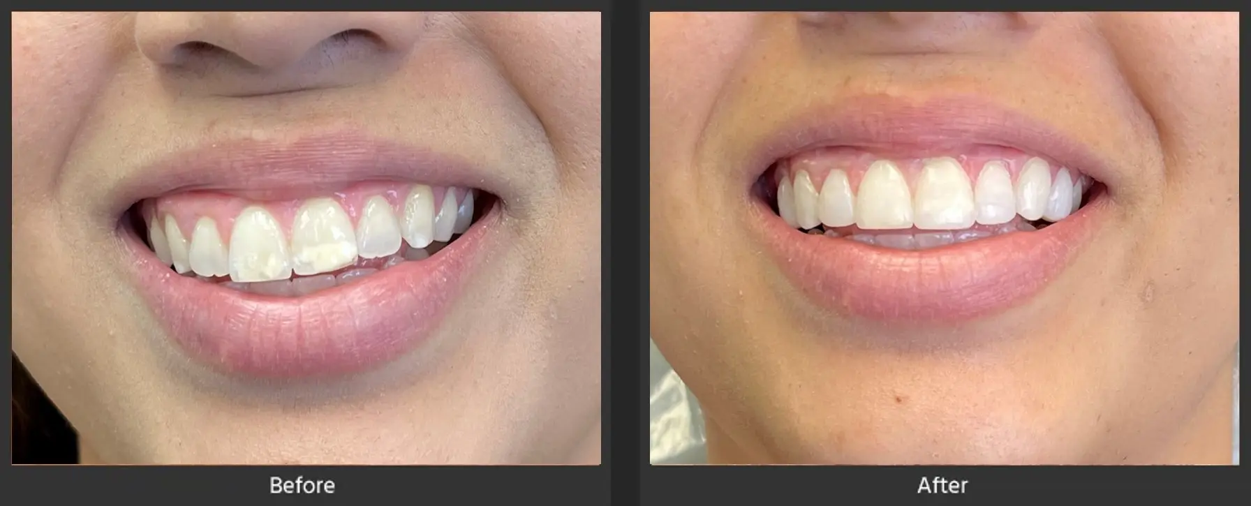 dentalavenu_1