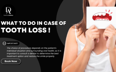 What to do in Case of Tooth Loss ! in Miami, FL