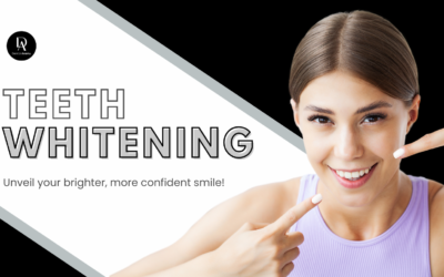 Teeth Whitening in Pinecrest, FL