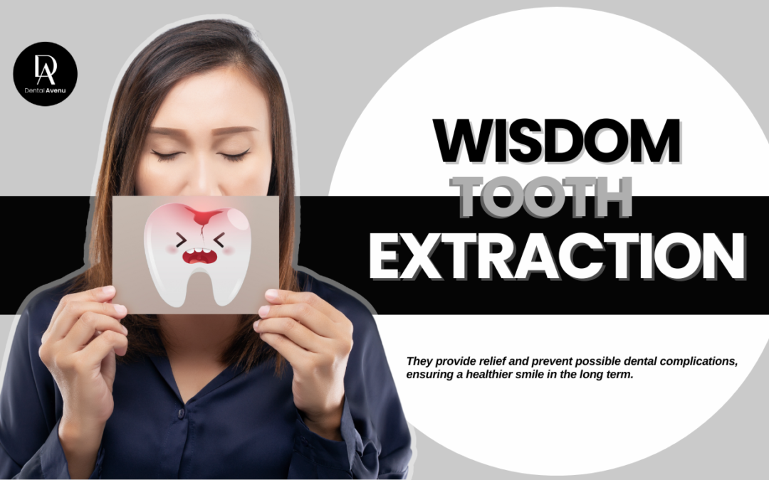 Wisdom Tooth Extraction  in Miami, FL