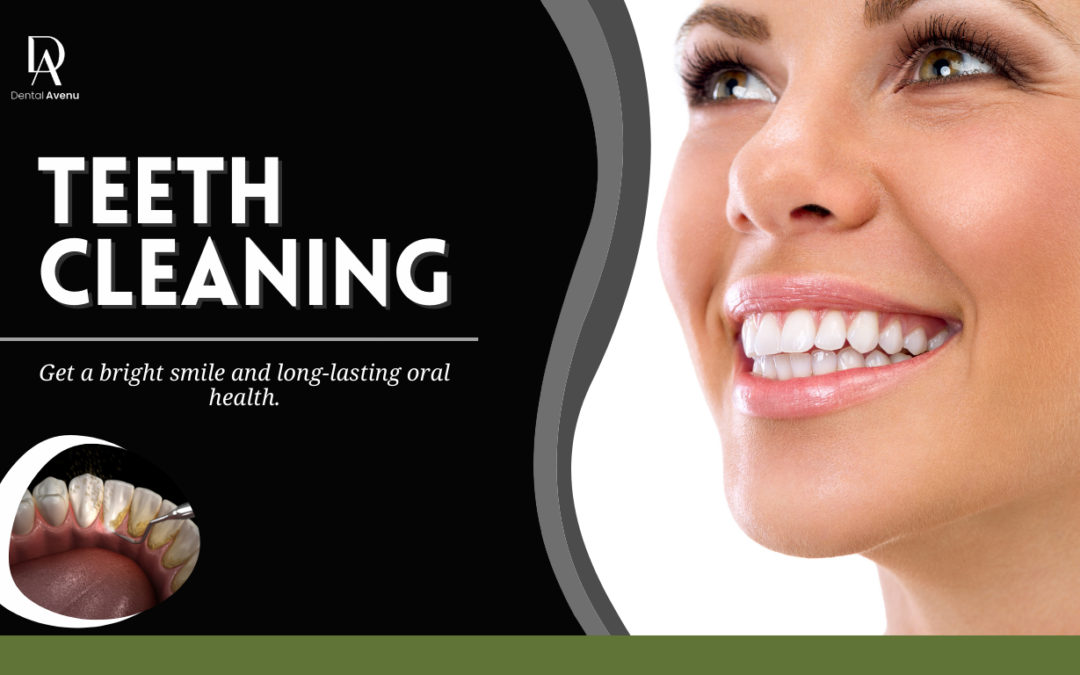Teeth Cleaning in Pinecrest, FL