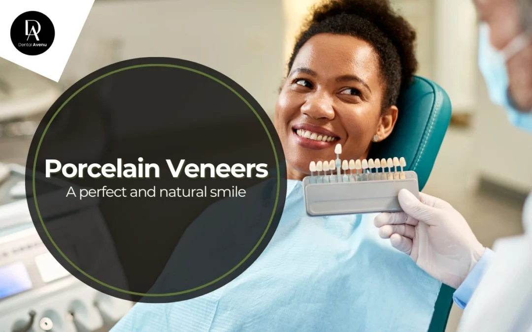 The Comprehensive Guide to Porcelain Veneers: Benefits, Healing Time, and More