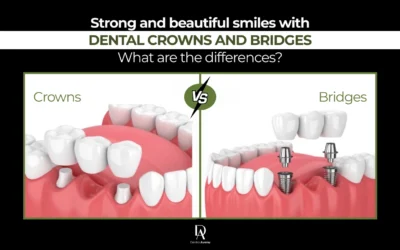 Complete Guide to Dental Crowns and Bridges in Pinecrest, FL